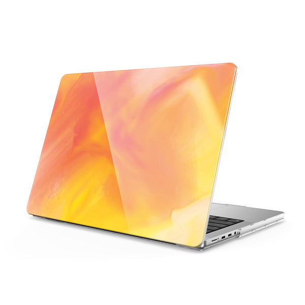 attract | Macbook Anti-Fall Protective Case