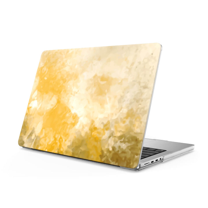 Bosque de Otoño | Funda protectora anticaída para Macbook 
