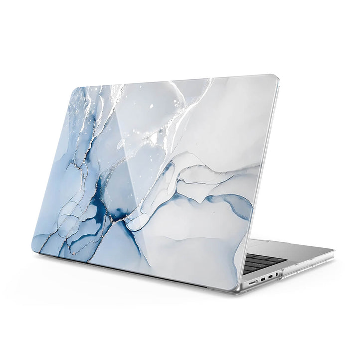 Jazz Silver | Macbook Anti-Fall Protective Case